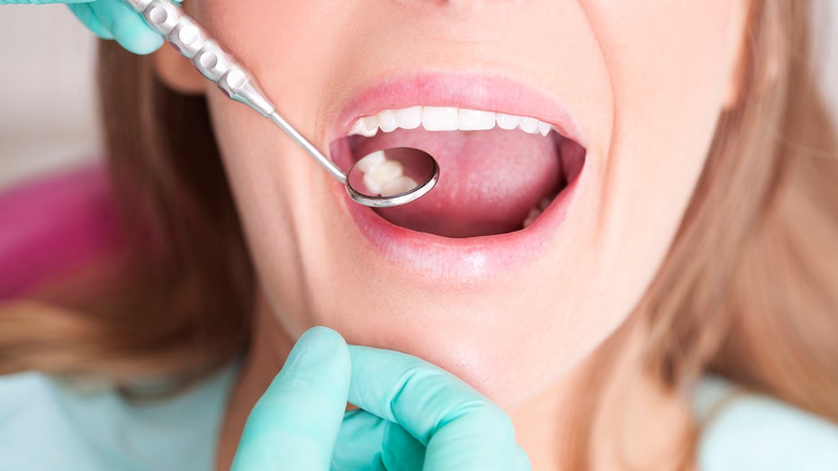 Cavities Uncovered: Common Causes and Prevention Tips for Tooth Decay