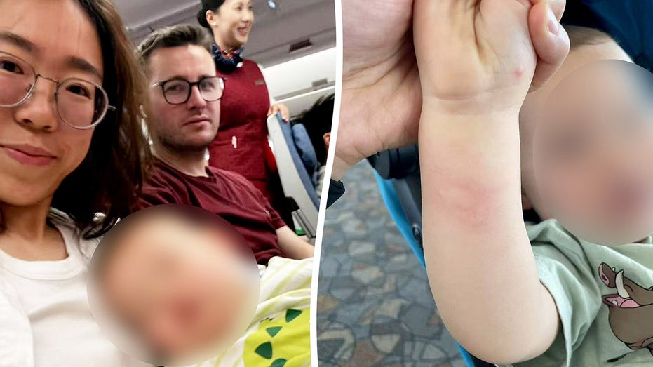 Family Grounded by British Airways Over Toddler’s Insect Bites Despite Doctor’s OK