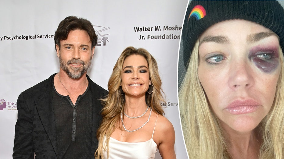 Denise Richards’ Estranged Husband Aaron Phypers Denies Shocking Abuse Allegations