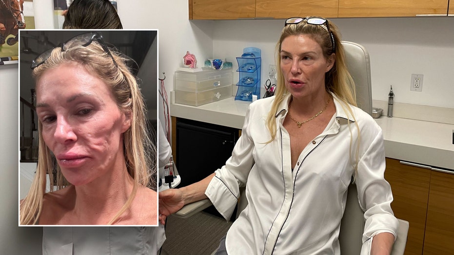 Brandi Glanville’s Mystery Illness Lands Her in Hospital After Terrifying Symptoms