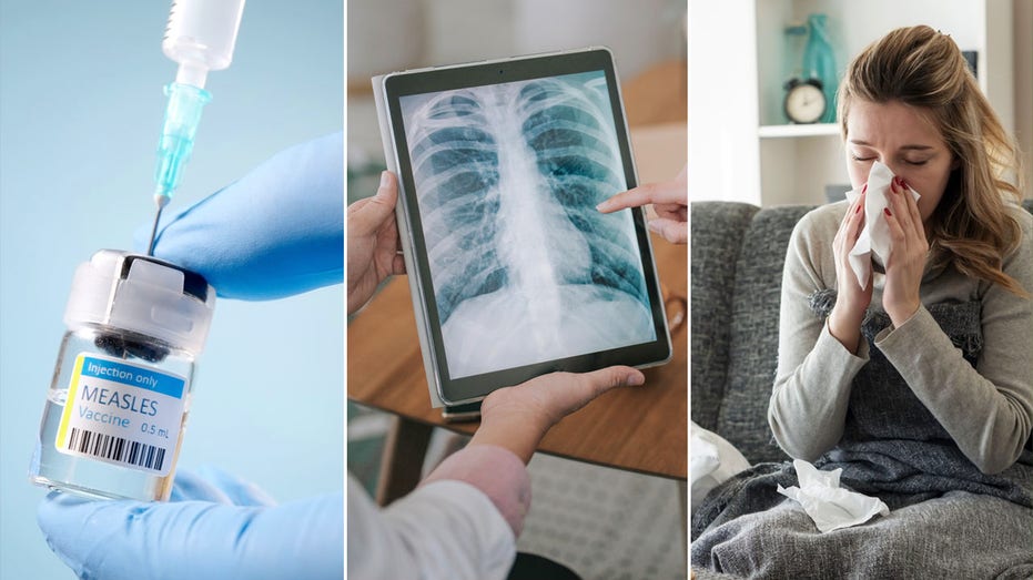 Health Headlines: Women's Health Focus, Farm Flu Outbreak, and Winter Skin Savers