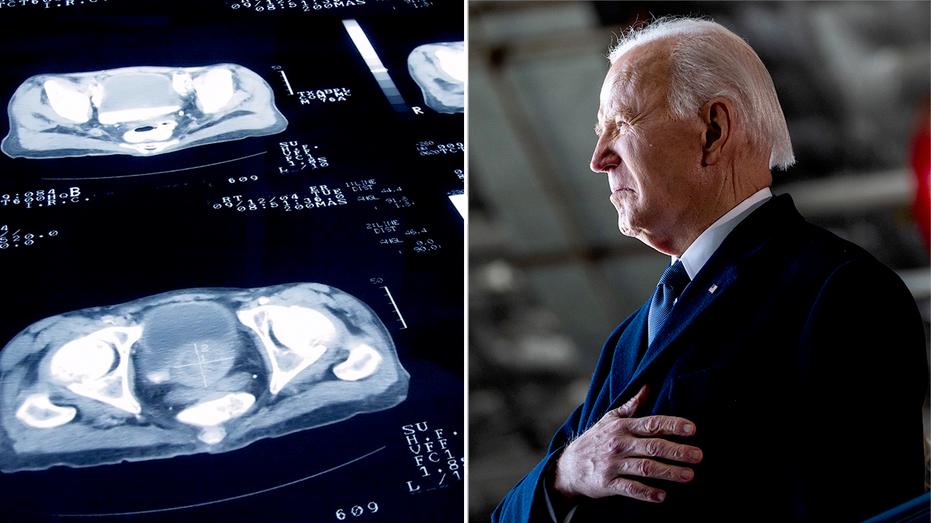 Joe Biden’s Prostate Cancer Battle: Understanding His Gleason 9 Diagnosis