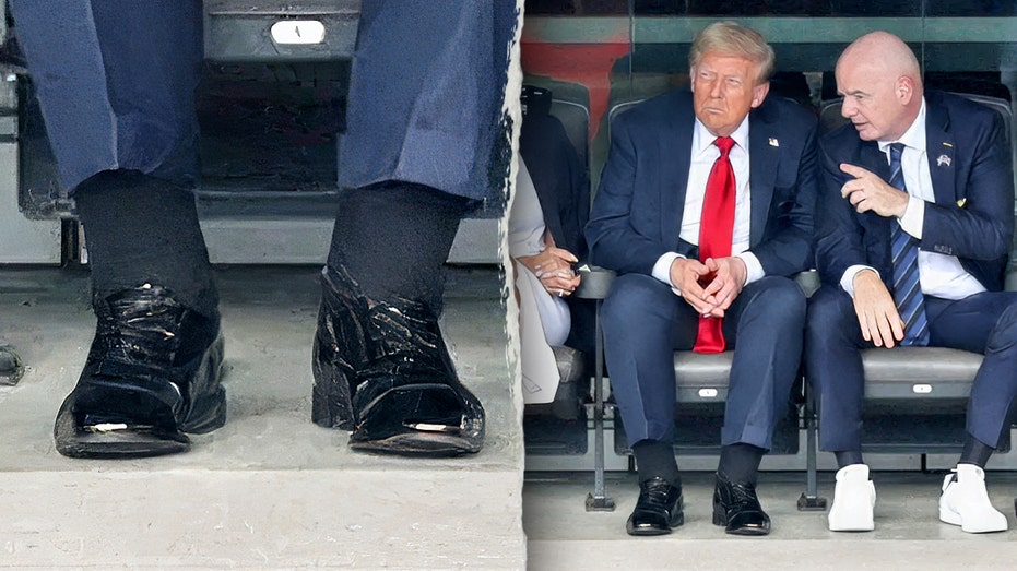 Trump Health Update: Doctors Explain Swollen Legs and Bruising as Benign