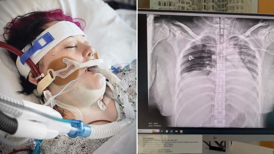 ‘I Vaped for One Year and Almost Died’