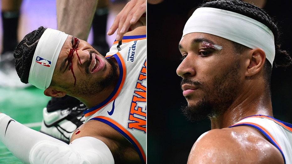 Knicks’ Josh Hart Bloodied in Game 5 Loss to Celtics, Tensions Flare with Jaylen Brown