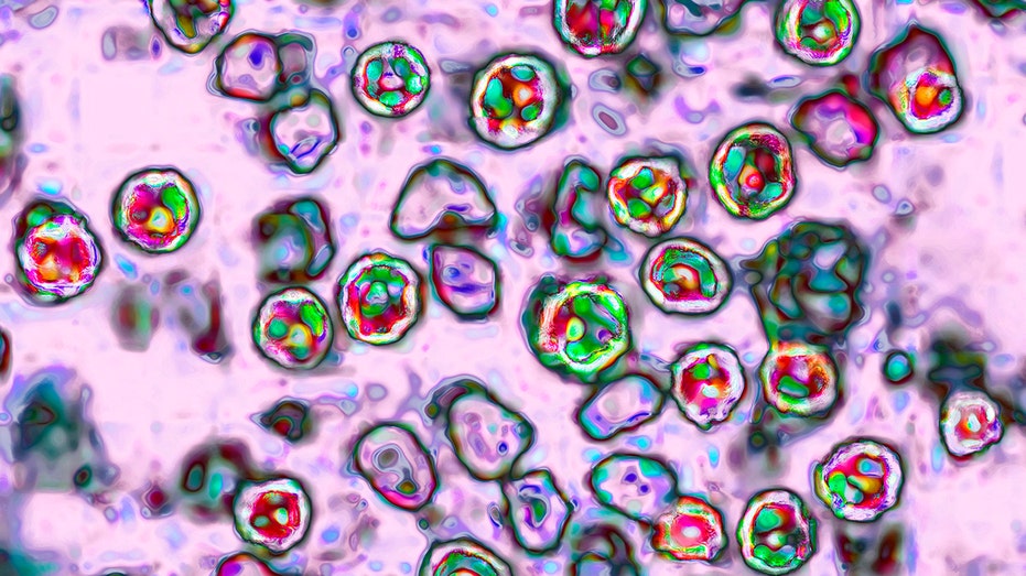 tennessee-reports-first-measles-case-amid-us-outbreak
