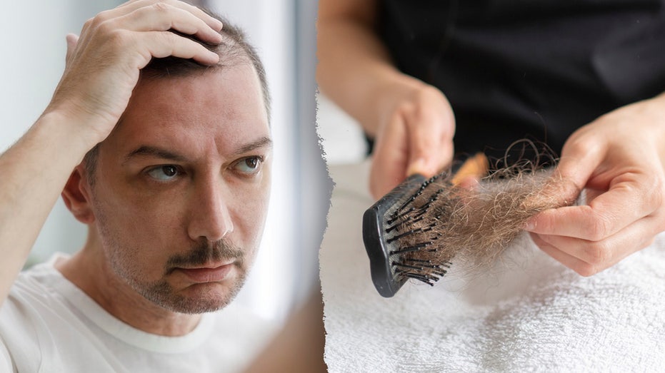 Ozempic and Semaglutides Linked to Hair Loss: What You Need to Know