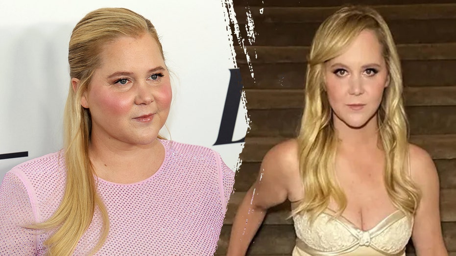Amy Schumer’s Cushing’s Syndrome Isn’t a Weight-Loss Story — It’s a Warning About How We Treat Women’s Health