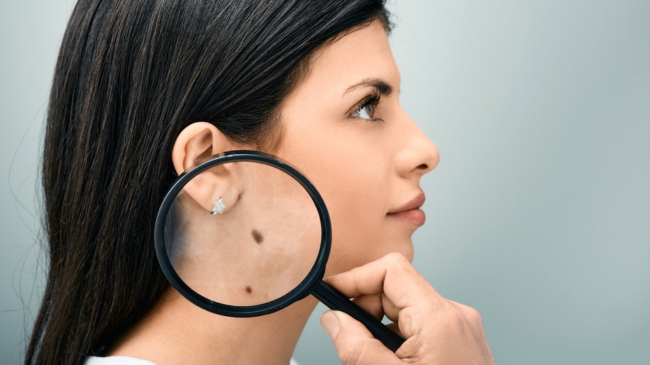 New Blood Test Shows Promise in Predicting Skin Cancer's Sneaky Return