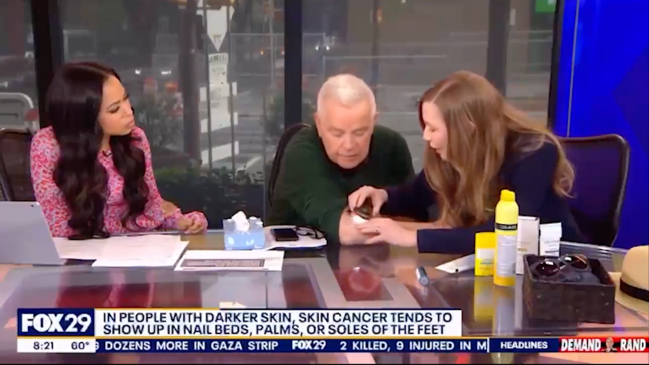 TV Host Shocked by Live On-Air Skin Cancer Diagnosis
