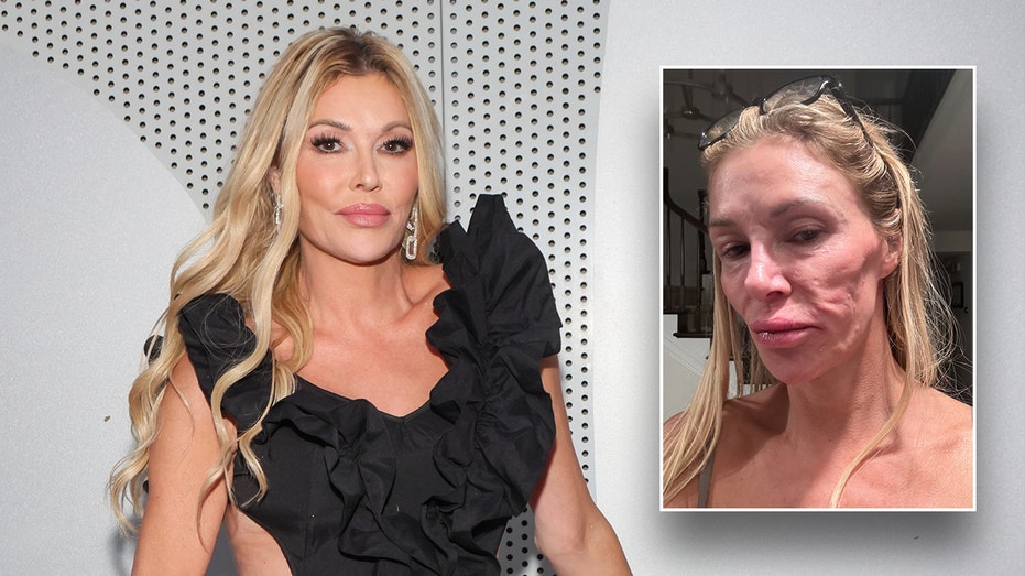 Brandi Glanville Opens Up About Mysterious Illness That Halted Her Love Life